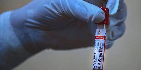 ಕೊರೋನಾ ವೈರಸ್ ಮಾದರಿ ಸಂಗ್ರಹ (ಸಂಗ್ರಹ ಚಿತ್ರ)