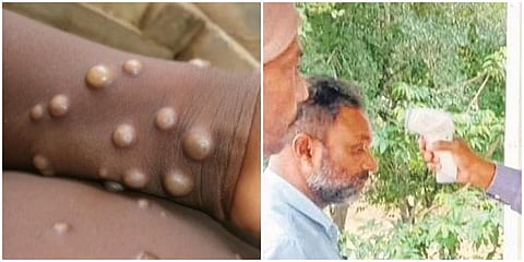 ಸಾಂದರ್ಭಿಕ ಚಿತ್ರ