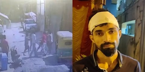 ಹಲ್ಲೆಗೊಳಗಾದ ಬೇಕರಿ ಮಾಲೀಕ ಮಂಜುನಾಥ್ ಶೆಟ್ಟಿ