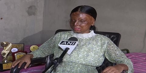 ಆ್ಯಸಿಡ್ ದಾಳಿ ಸಂತ್ರಸ್ತೆ ಕೈಫಿ
