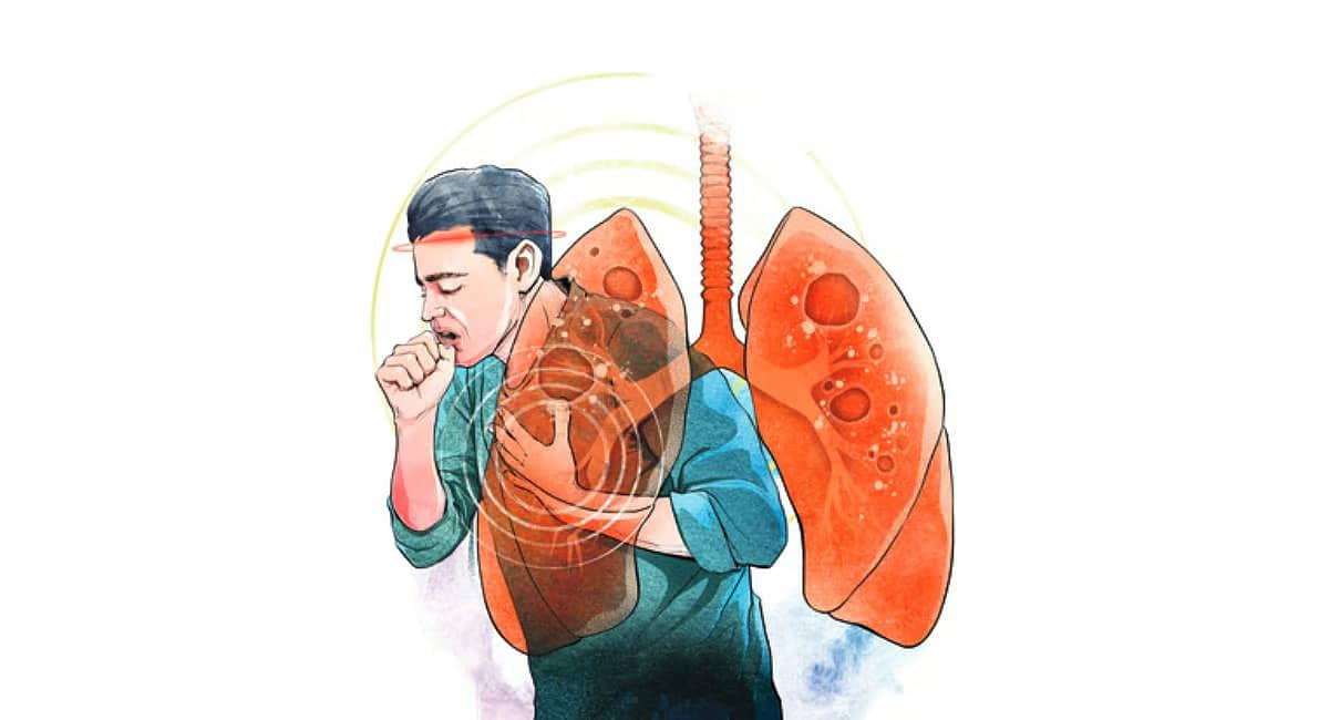 World TB Day: ಜನರ ಜೀವನ ಮಟ್ಟ ಸುಧಾರಣೆಗೆ ಸರ್ಕಾರಕ್ಕೆ IMA ಸಲಹೆ