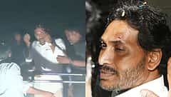 ವಿಜಯವಾಡ: ರೋಡ್ ಶೋ ವೇಳೆ ಕಲ್ಲು ಎಸೆತ, ಸಿಎಂ ಜಗನ್ ಮೋಹನ್ ರೆಡ್ಡಿಗೆ ಗಾಯ