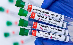 ಭಾರತದಲ್ಲಿ ಮೊದಲ Mpox ಪ್ರಕರಣ ದೃಢ; ಸಾರ್ವಜನಿಕರಿಗೆ ತಕ್ಷಣಕ್ಕೆ ಯಾವುದೇ ಅಪಾಯವಿಲ್ಲ: ಕೇಂದ್ರ
