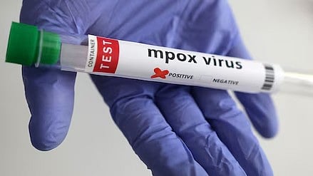 ಭಾರತದಲ್ಲಿ ಮೊದಲ ಶಂಕಿತ 'ಮಂಕಿಪಾಕ್ಸ್ ' ಪ್ರಕರಣ: ಆತಂಕ ಪಡುವ ಅಗತ್ಯವಿಲ್ಲ- ಕೇಂದ್ರ ಆರೋಗ್ಯ ಸಚಿವಾಲಯ