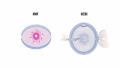 ಐಸಿಎಸ್ಐ ಫಲವಂತಿಕೆ ಚಿಕಿತ್ಸೆ ಅಥವಾ ICSI Fertility Treatment (ಕುಶಲವೇ ಕ್ಷೇಮವೇ)