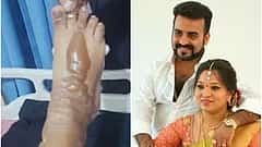 ಸ್ಟೀಮ್ ತೆಗೆದುಕೊಳ್ಳುವಾಗ ಬಿಸಿ ನೀರು ಬಿದ್ದು ಆಕಸ್ಮಿಕ: ಮಾಸ್ಟರ್ ಆನಂದ್ ಪತ್ನಿ ಕಾಲಿಗೆ ಗಾಯ, ಫೋಟೋ ವೈರಲ್