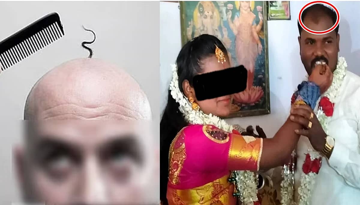ಚಾಮರಾಜನಗರ: 'ನಿನ್ನ ಜೊತೆ ಹೊರಗೆ ಹೋಗಲು ನಾಚಿಕೆ ಆಗುತ್ತೆ'; ಬೋಳುತಲೆ ಬಗ್ಗೆ ಪತ್ನಿ ಗೇಲಿ, ಮನನೊಂದು ಪತಿ ನೇಣಿಗೆ ಶರಣು!