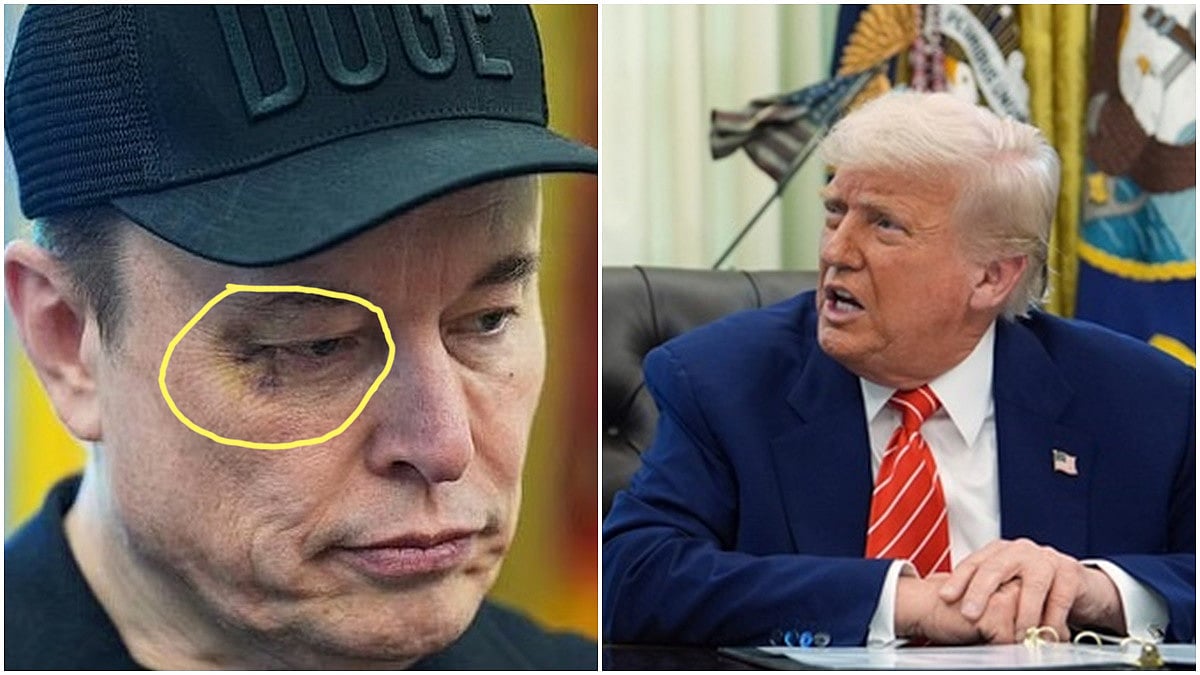 White house ಬೀಳ್ಕೊಡುಗೆ ವೇಳೆ ಮಸ್ಕ್ "Black Eye" ಮೇಲೆ ಎಲ್ಲರ ಕಣ್ಣು: ಪಂಚ್ ಮಾಡಿದ್ಯಾರು?