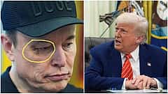 White house ಬೀಳ್ಕೊಡುಗೆ ವೇಳೆ ಮಸ್ಕ್ "Black Eye" ಮೇಲೆ ಎಲ್ಲರ ಕಣ್ಣು: ಪಂಚ್ ಮಾಡಿದ್ಯಾರು?