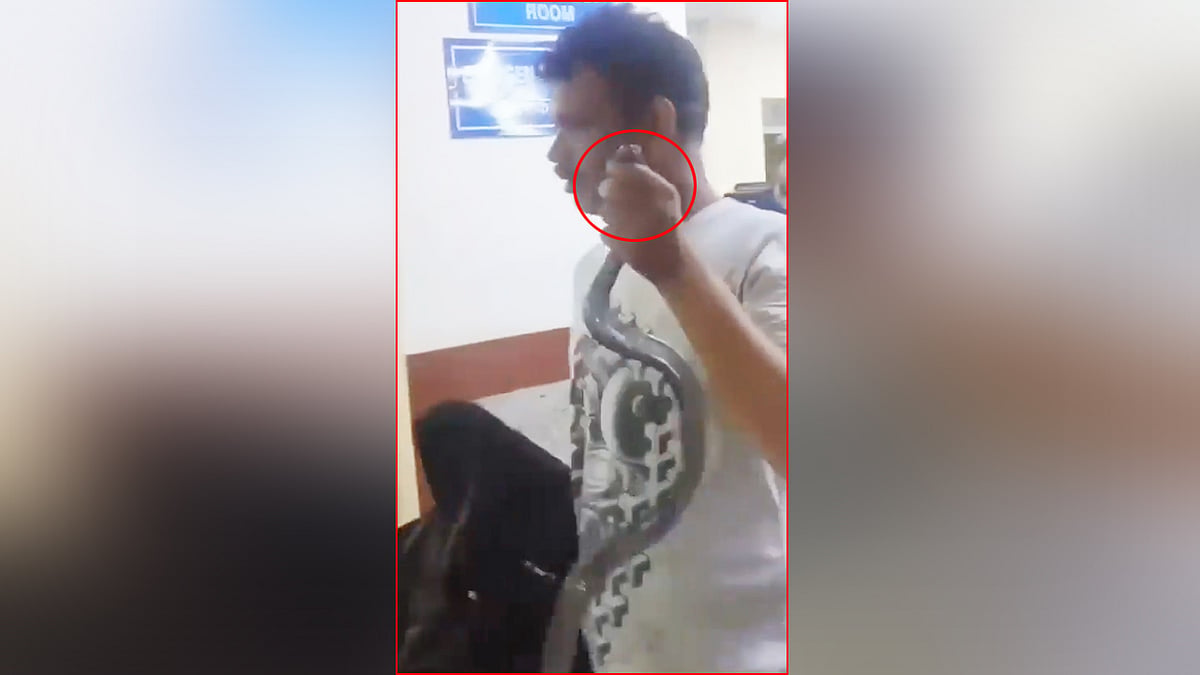 ''ಈ ಹಾವೇ ನಂಗೆ ಕಚ್ಚಿದ್ದು.. Treatment ಕೊಡಿ": ಹಾವಿನ ಸಮೇತ ಆಸ್ಪತ್ರೆಗೆ ಬಂದ ಭೂಪ, ಬೆಚ್ಚಿಬಿದ್ದ ವೈದ್ಯರು! Video Viral