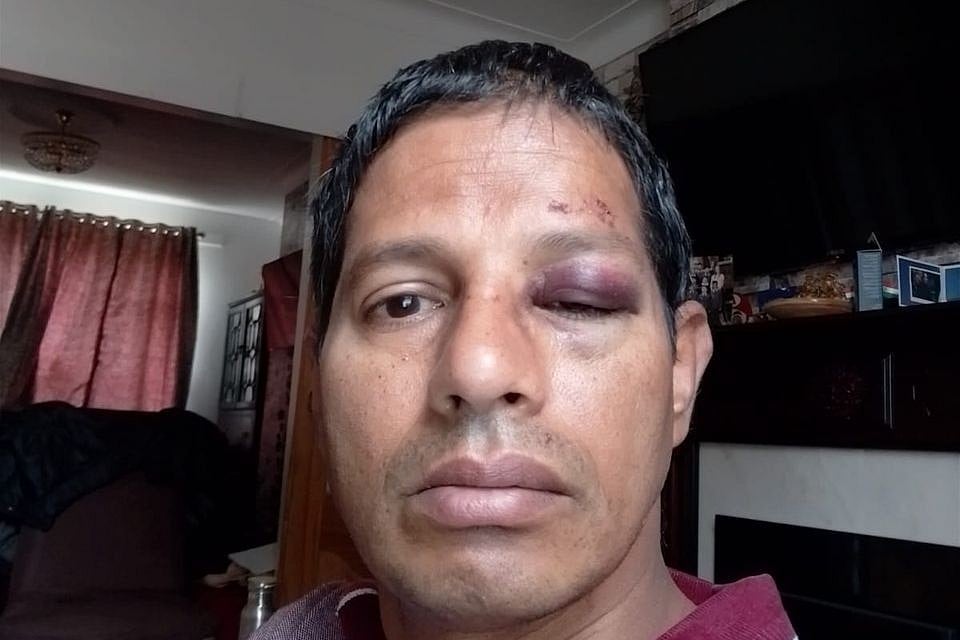 ಐರ್ಲೆಂಡ್‌ನಲ್ಲಿ ಭಾರತೀಯರ ಮೇಲಿನ ಹಲ್ಲೆ ಹೆಚ್ಚಳ: 20 ವರ್ಷಗಳಿಂದ ವಾಸಿಸುತ್ತಿದ್ದ ವ್ಯಕ್ತಿ ಮೇಲೆ ಮಾರಣಾಂತಿಕ ಹಲ್ಲೆ