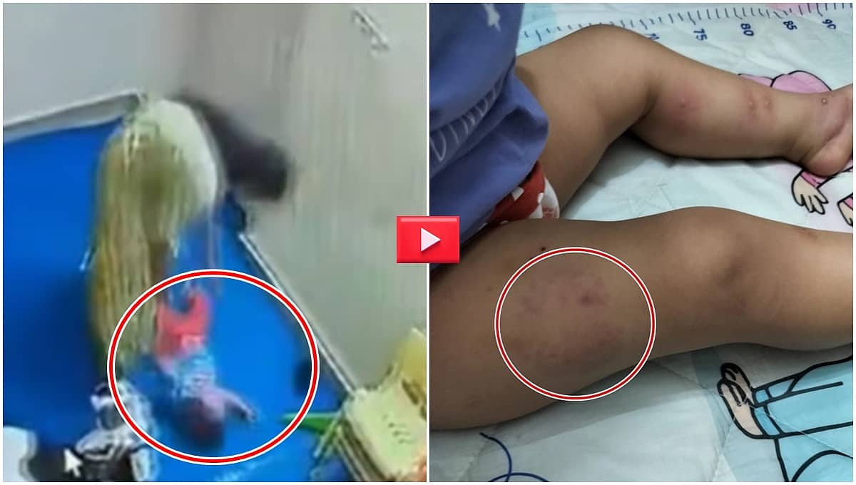 Noida Daycare Horror: 15 ತಿಂಗಳ ಮಗುವಿಗೆ ಕಚ್ಚಿ, ಥಳಿಸಿ, ನೆಲಕ್ಕೆ ಕುಕ್ಕಿ ವಿಕೃತಿ ಮೆರೆದ ಕೆಲಸದಾಕೆ; Video!
