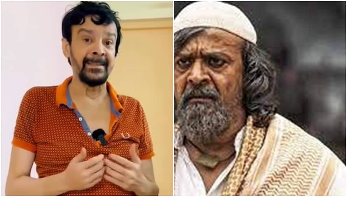 Thyroid Cancer: ಗುರುತೇ ಸಿಗಲಾರದಷ್ಟು ಬದಲಾದ ನಟ! 'ರಾಯ್' ಗೆ ಬೇಕಾಗಿದೆ ನೆರವು; Video