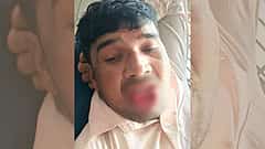 ಬಲವಂತವಾಗಿ ಚುಂಬಿಸಿದ ಮಾಜಿ ಪ್ರಿಯಕರ, ನಾಲಿಗೆಯನ್ನೇ ಕಚ್ಚಿ ಕಿತ್ತೆಸೆದ ಮಹಿಳೆ!