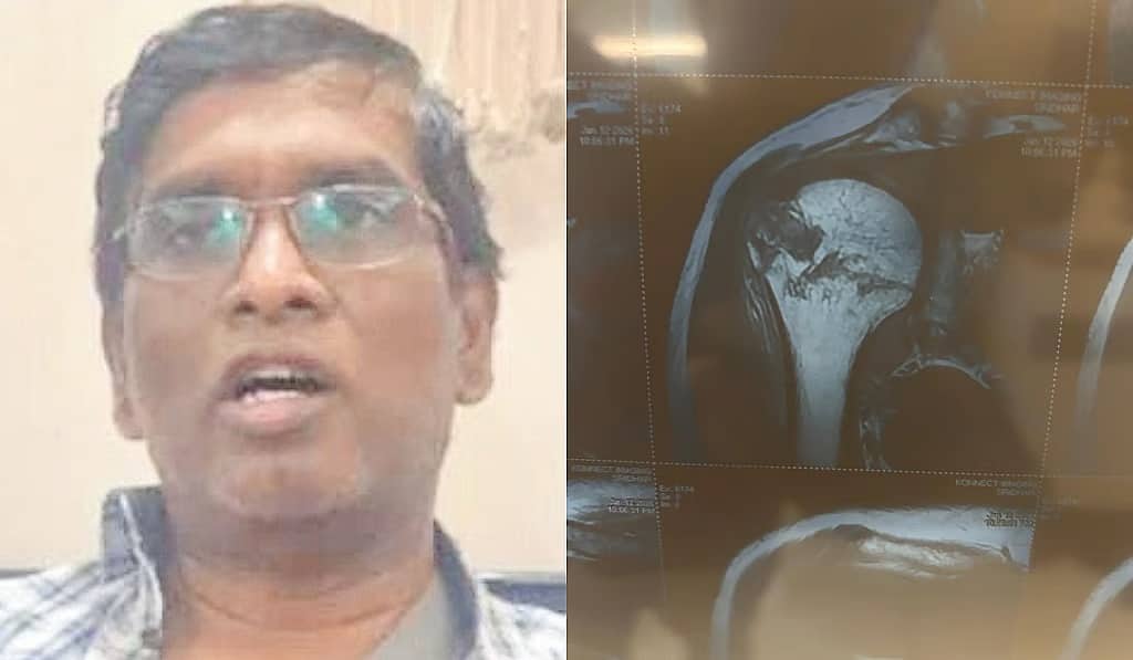 ಬೆಂಗಳೂರು ವಾಹನ ಸವಾರರಿಗೆ ತಪ್ಪದ ಸಂಕಷ್ಟ: ರಸ್ತೆ ಗುಂಡಿಗೆ ಬಿದ್ದು ಭುಜದ ಮೂಳೆ ಮುರಿದುಕೊಂಡ ಟೆಕ್ಕಿ..!