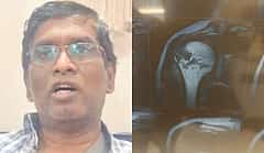 ಬೆಂಗಳೂರು ವಾಹನ ಸವಾರರಿಗೆ ತಪ್ಪದ ಸಂಕಷ್ಟ: ರಸ್ತೆ ಗುಂಡಿಗೆ ಬಿದ್ದು ಭುಜದ ಮೂಳೆ ಮುರಿದುಕೊಂಡ ಟೆಕ್ಕಿ..!
