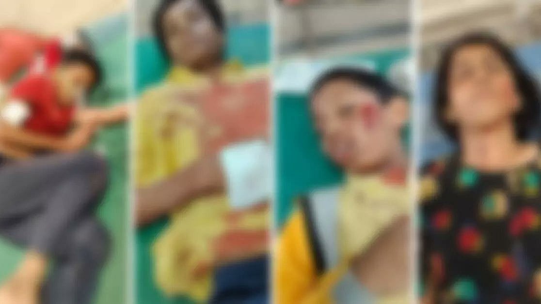 ಬಳ್ಳಾರಿ ವಸತಿ ಶಾಲೆಯಲ್ಲಿ ಅಘಾತಕಾರಿ ಘಟನೆ: ಸಹಪಾಠಿಗಳ ಮೇಲೆ ವಿದ್ಯಾರ್ಥಿ ದಾಳಿ; ಓರ್ವ ಸಾವು, 7 ಮಂದಿ ಸ್ಥಿತಿ ಗಂಭೀರ