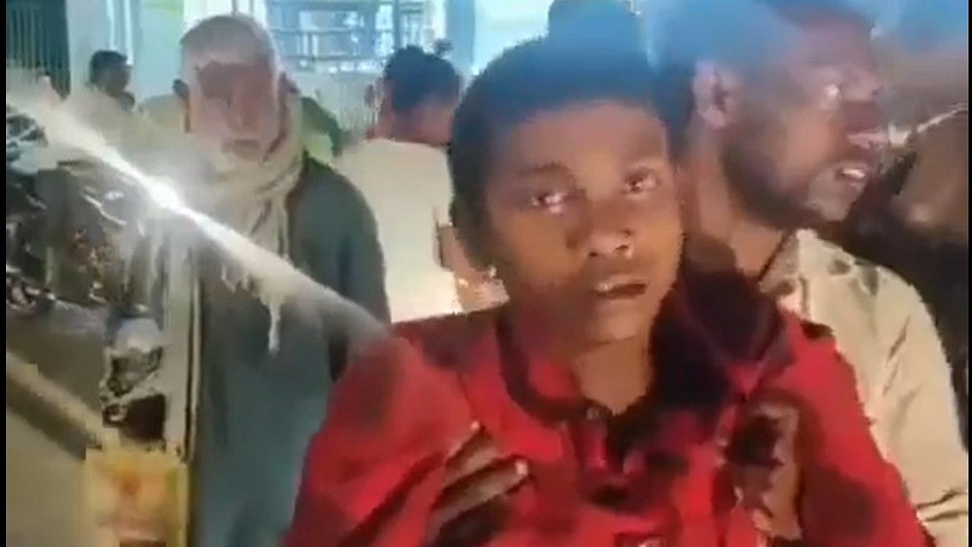 Shocking: ನಾಯಿ ಕಡಿತಕ್ಕೆ ಪೂರ್ಣ ಲಸಿಕೆ ಪಡೆಯದೆ ನಿರ್ಲಕ್ಷ್ಯ; ರೇಬಿಸ್ ಕಾಯಿಲೆಯಿಂದ ನಾಯಿಯಂತೆ ಬೊಗಳುತ್ತಿರುವ ಬಾಲಕ..! Video