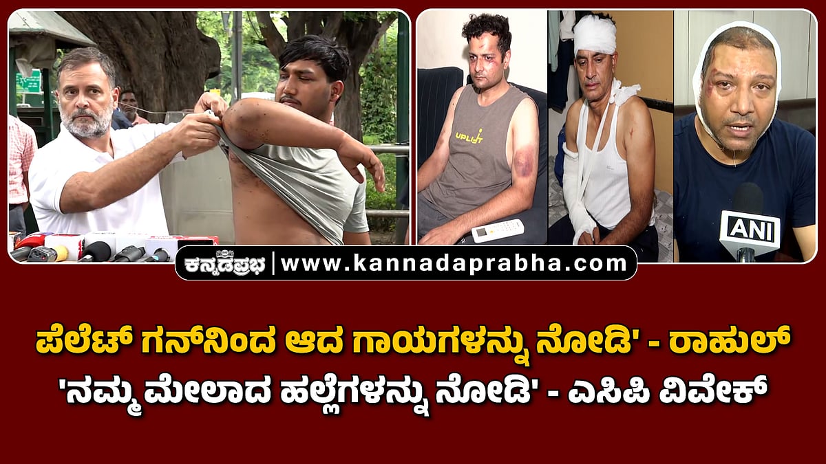 Watch | ಪೆಲೆಟ್ ಗನ್ನಿಂದ ಆದ ಗಾಯಗಳನ್ನು ನೋಡಿ'- ರಾಹುಲ್; 'ನಮ್ಮ ಮೇಲಾದ ಹಲ್ಲೆಗಳನ್ನು ನೋಡಿ'- ಎಸಿಪಿ ವಿವೇಕ್