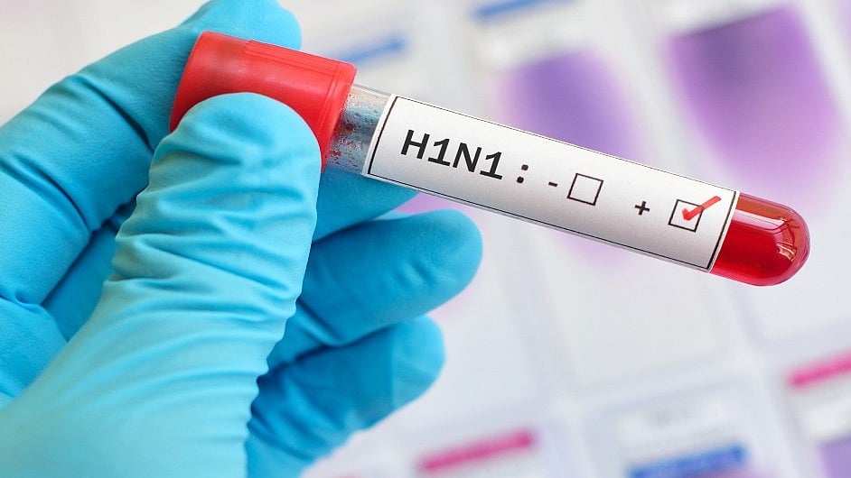 ರಾಜ್ಯದಲ್ಲಿ H1N1 ಪ್ರಕರಣಗಳ ಏರಿಕೆ: ಮಳೆಗಾಲದಲ್ಲಿ ಇದು ಸಾಮಾನ್ಯ, ಆತಂಕ ಬೇಡ- ರಾಜ್ಯ ಸರ್ಕಾರ
