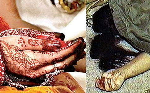ವರದಕ್ಷಿಣೆ ಸಾವು: ತಾಯಿ, ಮಗನಿಗೆ 10 ವರ್ಷ ಜೈಲು