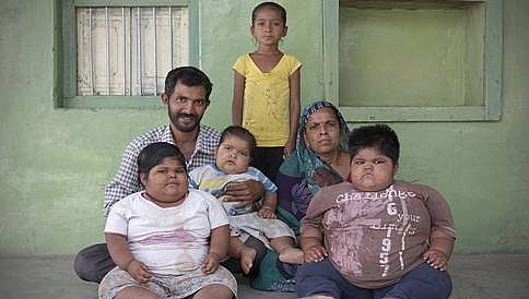 ಮಕ್ಕಳ ರೋಗ ಗುಣಪಡಿಸಲು ಕಿಡ್ನಿ ಮಾರಲು ಮುಂದಾದ ತಂದೆ