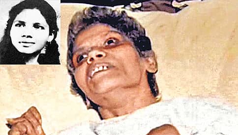 ಅರುಣಾ ಶಾನ್ಭಾಗ್ - 42 ವರ್ಷಗಳ ನೋವಿನ ಕಥೆ