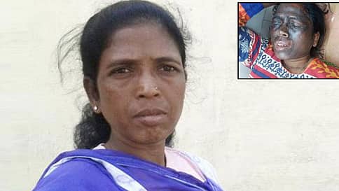 ಆಮ್ ಆದ್ಮಿ ಪಕ್ಷದ ನೇತಾರೆ ಮೇಲೆ ಆ್ಯಸಿಡ್ ದಾಳಿ