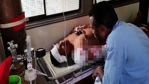 ಆರ್‌ಎಸ್‌ಎಸ್ ರಿಕ್ಷಾ ಚಾಲಕನಿಗೆ ಸಿಪಿಎಂ ಬೆಂಬಲಿಗರಿಂದ ಹಲ್ಲೆ