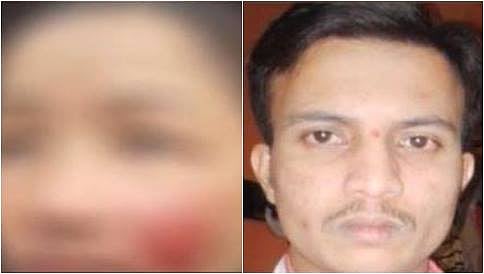 ಬೆಂಗಳೂರು: ಮಲಗಿದ್ದ ಮಹಿಳೆಯ ಕೆನ್ನೆ ಕಚ್ಚಿ ಯುವಕ ಪರಾರಿ