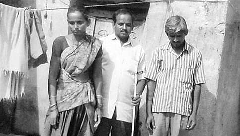 ಈ ಗ್ರಾಮದ ಪ್ರತಿ ಮೂರು ಮನೆಯ ಒಬ್ಬರಲ್ಲಿ ಅಂಗವೈಕಲ್ಯ