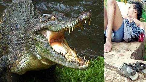 ಬೆಂಗಳೂರು: ನಾಯಿ ರಕ್ಷಿಸಲು ಹೋದ ಯುವಕನ ಕೈ ಕಿತ್ತು ತಿಂದ ಮೊಸಳೆ