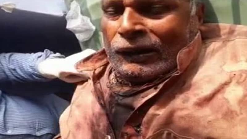 ಉತ್ತರ ಪ್ರದೇಶ: ಕೊಡಲಿಯಿಂದ ತಂದೆಯ ಕತ್ತು ಸೀಳಿದ ಮಗ ಬಳಿಕ ಫೆವಿಕ್ವಿಕ್ ಬಳಸಿ ಅಂಟಿಸಲು ನೋಡಿದ!