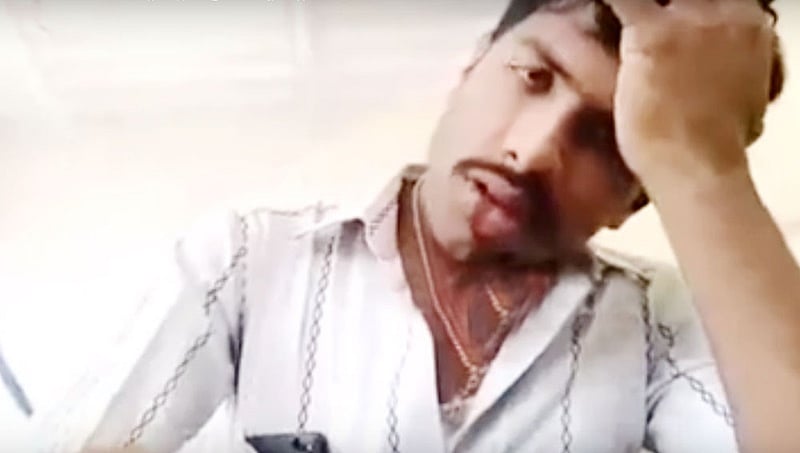 ಚಿಂತಾಮಣಿ: ವಿಡಿಯೋ ಮಾಡಿ ಆತ್ಮಹತ್ಯೆಗೆ ಶರಣಾದ ಹೋಂಗಾರ್ಡ್