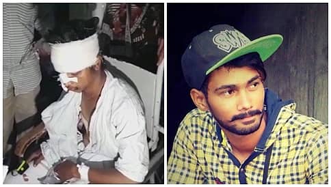 ದಾವಣಗೆರೆ: ಗರ್ಲ್ ಫ್ರೆಂಡ್ ಸ್ನೇಹಿತನ ಮೇಲೆ ಕಾಂಗ್ರೆಸ್ ಕಾರ್ಪೊರೇಟರ್ ಪುತ್ರ ಹಲ್ಲೆ