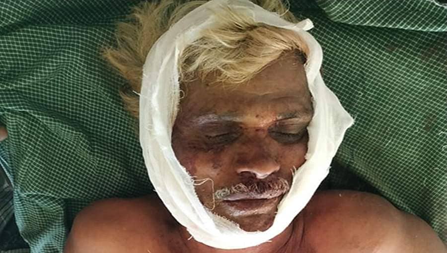 ಬಂಡಿಪುರ: ಆನೆ ದಾಳಿಯಿಂದ ವ್ಯಕ್ತಿಗೆ ಗಂಭೀರ ಗಾಯ, ಜಾನುವಾರು ಬಲಿ