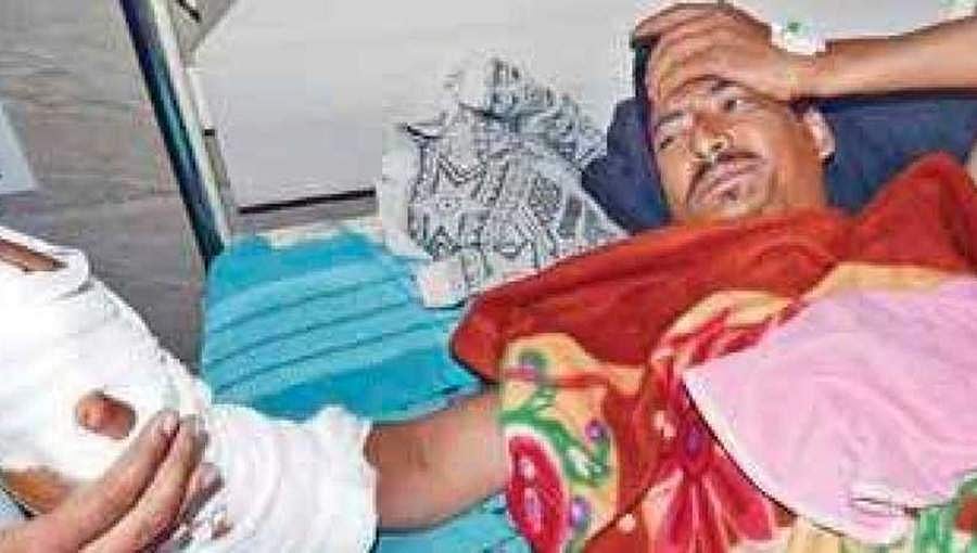 ಬಿಸಾಡಲು ಹೋದಾಗ ಕೈಯಲ್ಲಿಯೇ ಬಾಂಬ್ ಸ್ಫೋಟಗೊಂಡಿತ್ತು: ಗಾಯಾಳು ಹುಸೇನ್