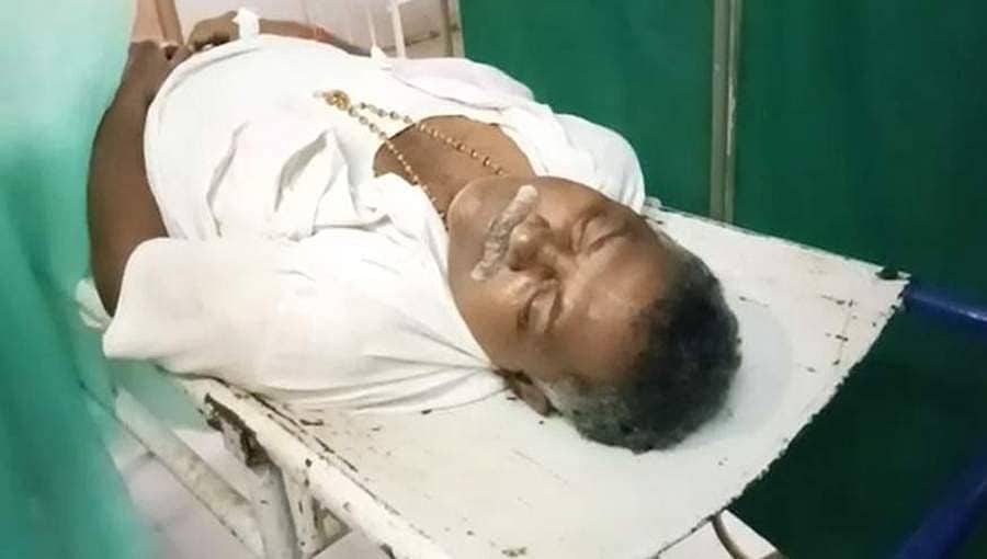 ಸಬ್ಸಿಡಿ ದರದಲ್ಲಿ ಈರುಳ್ಳಿ ಮಾರಾಟ: ಸಾಲಿನಲ್ಲಿ ನಿಂತಿದ್ದ ವ್ಯಕ್ತಿಗೆ ಹೃದಯ ಸ್ತಂಭನ, ಸಾವು