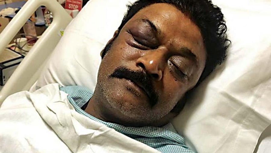 ಹಲ್ಲೆ ಪ್ರಕರಣ: ಶಾಸಕ ಆನಂದ್ ಸಿಂಗ್ ಆಸ್ಪತ್ರೆಯಿಂದ ಡಿಸ್ಚಾರ್ಜ್