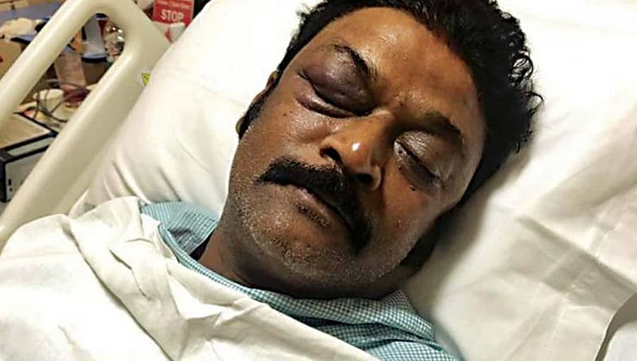 ಹಲ್ಲೆ ಪ್ರಕರಣ: ಶಾಸಕ ಆನಂದ್ ಸಿಂಗ್ ಆಸ್ಪತ್ರೆಯಿಂದ ಡಿಸ್ಚಾರ್ಜ್