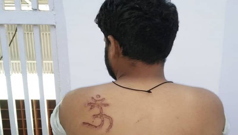 ಕೈದಿಗೆ "ಓಂ' ಚಿಹ್ನೆಯ ಬರೆ: ತನಿಖೆಗೆ ದೆಹಲಿ ನ್ಯಾಯಾಲಯ ಆದೇಶ