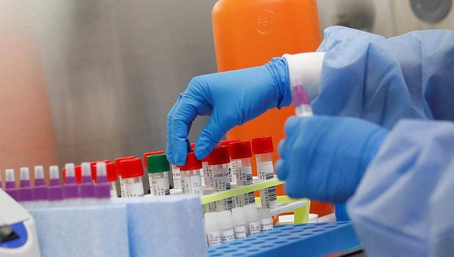 ಭಾರತದಲ್ಲಿ ಇದುವರೆಗೂ 3 ಕೋಟಿ ಜನರಿಗೆ ಕೋವಿಡ್ ಪರೀಕ್ಷೆ ನಡೆಸಲಾಗಿದೆ: ಐಸಿಎಂಆರ್