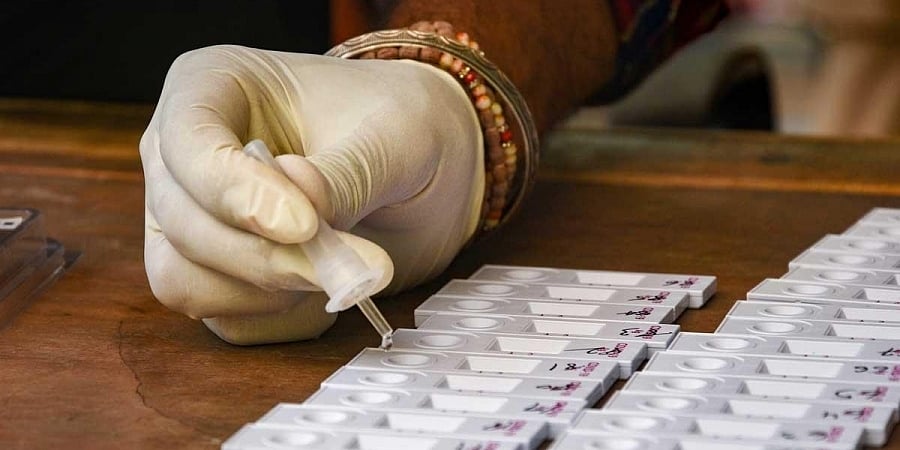 ದೇಶದಲ್ಲಿ ಒಂದೇ ದಿನ ದಾಖಲೆಯ 20.61 ಲಕ್ಷ ಕೊರೋನಾ ಪರೀಕ್ಷೆ: ಕೇಂದ್ರ ಸರ್ಕಾರ