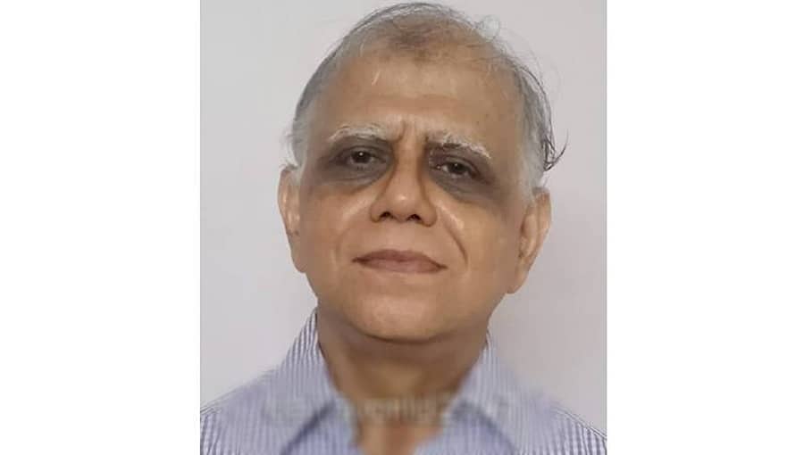 ಬ್ಲ್ಯಾಕ್ ಫಂಗಸ್ ಗೆ ಔಷಧಿ ಕಂಡುಹಿಡಿದ ಕರಾವಳಿ ಕನ್ನಡಿಗ ಶ್ರೀಕಾಂತ್ ಪೈ!