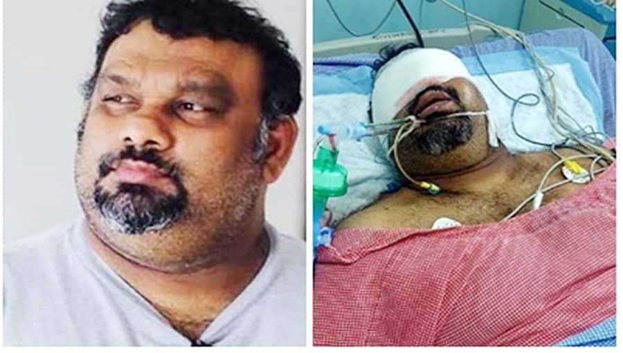 ಲಾರಿ-ಕಾರಿನ ನಡುವೆ ಭೀಕರ ಅಪಘಾತ: ಟಾಲಿವುಡ್ ನಟ ಕತ್ತಿ ಮಹೇಶ್ ಸ್ಥಿತಿ ಗಂಭೀರ