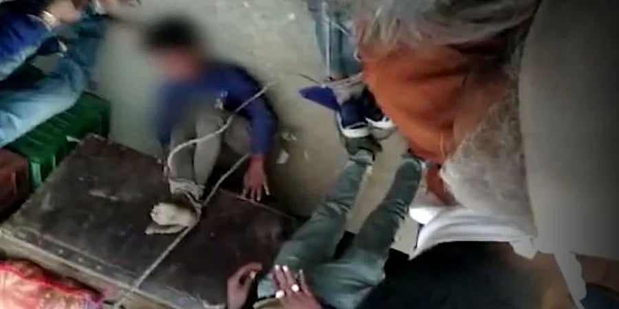 ಕಳ್ಳತನದ ಆರೋಪ: ಇಬ್ಬರು ಬಾಲಕರ ಕಾಲನ್ನು ವಾಹನಕ್ಕೆ ಕಟ್ಟಿ ಎಳೆದೊಯ್ದು ಹಲ್ಲೆ, ಮೂವರು ಶಂಕಿತರ ಬಂಧನ