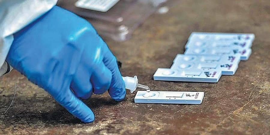 ಕೋವಿಡ್-19: ಕಳೆದ 24 ಗಂಟೆಗಳಲ್ಲಿ 102 ಹೊಸ ಕೊರೊನಾವೈರಸ್ ಪ್ರಕರಣ, ಮೂರು ಮಂದಿ ಸಾವು