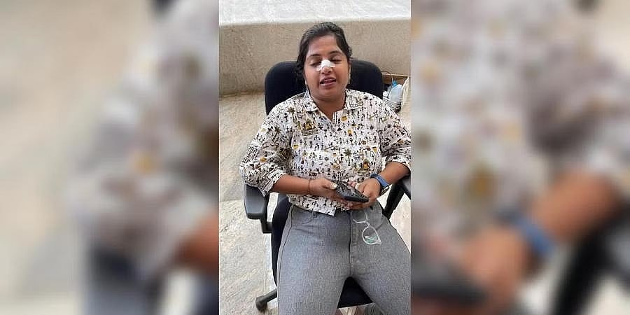 ವಿಮಾನ ನಿಲ್ದಾಣದಲ್ಲಿ ಪಾರದರ್ಶಕ ಗಾಜಿಗೆ ಗುದ್ದಿಕೊಂಡು ಮಹಿಳೆಗೆ ಗಾಯ: ಮೂಗಿನ ಮೂಳೆ ಮುರಿತ, ಶಸ್ತ್ರಚಿಕಿತ್ಸೆಗೆ ವೈದ್ಯರ ಸಲಹೆ!