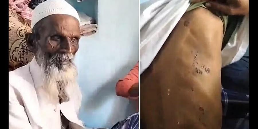 'ಜೈ ಶ್ರೀರಾಮ್' ಹೇಳುವಂತೆ ಒತ್ತಾಯ: ಹಿರಿಯ ಮುಸ್ಲಿಂ ವ್ಯಕ್ತಿಯ ಮೇಲೆ ಹಲ್ಲೆ, ಎಫ್ಐಆರ್ ದಾಖಲು!
