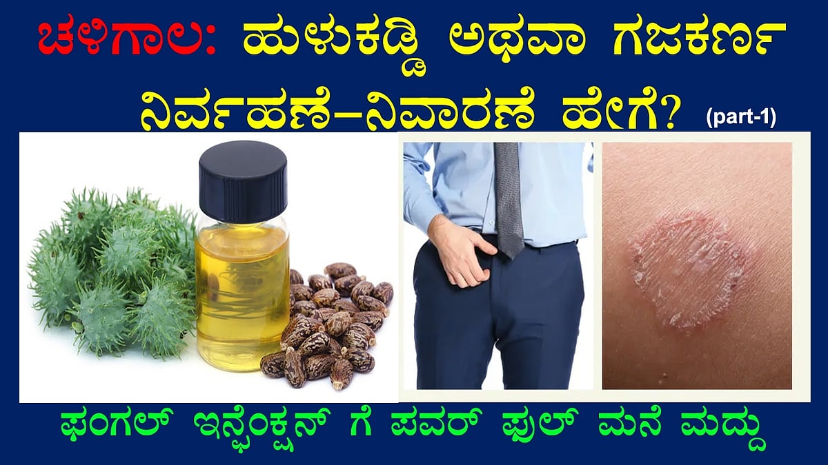 ಚಳಿಗಾಲ: ಹುಳುಕಡ್ಡಿ ಅಥವಾ ಗಜಕರ್ಣ ನಿರ್ವಹಣೆ-ನಿವಾರಣೆ ಹೇಗೆ? part-1